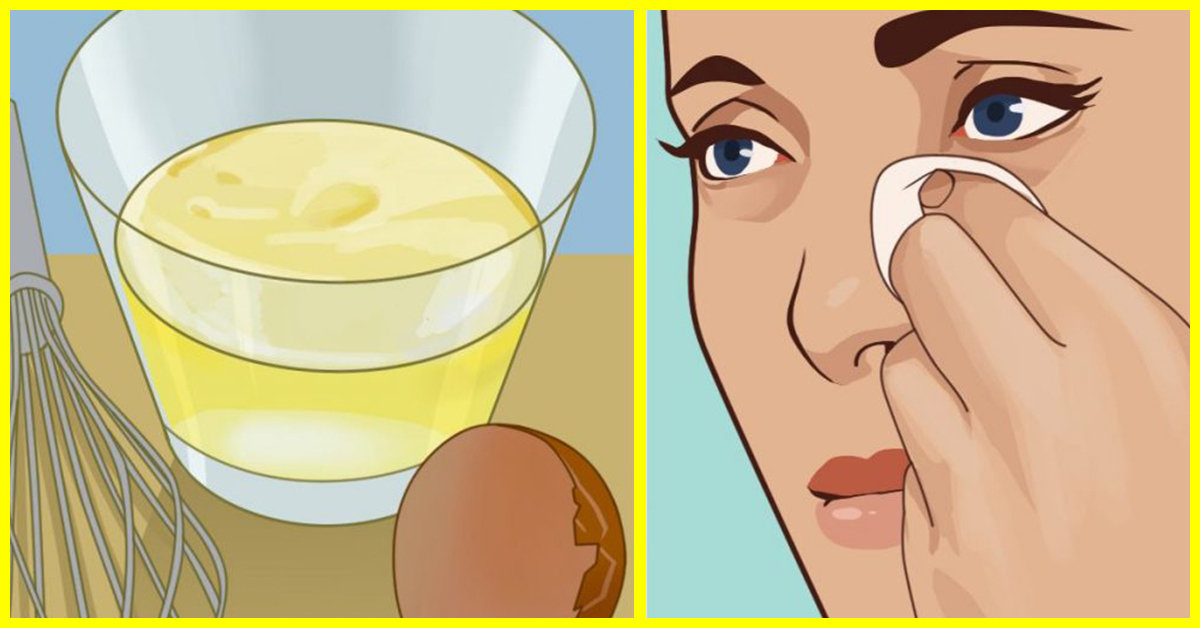 reduce eye puffiness using egg whites