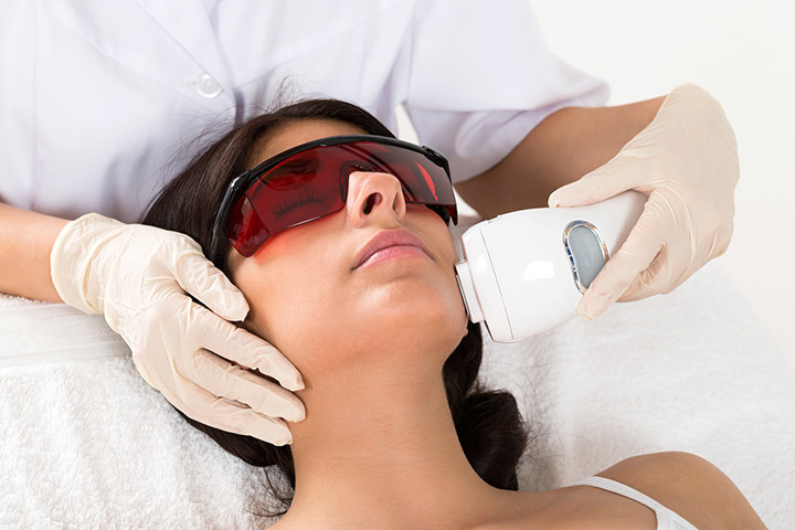 Women's facial hair removal - laser
