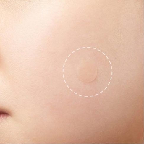 8 Things I Love About This Acne Patch Set ! - Biotyful.net